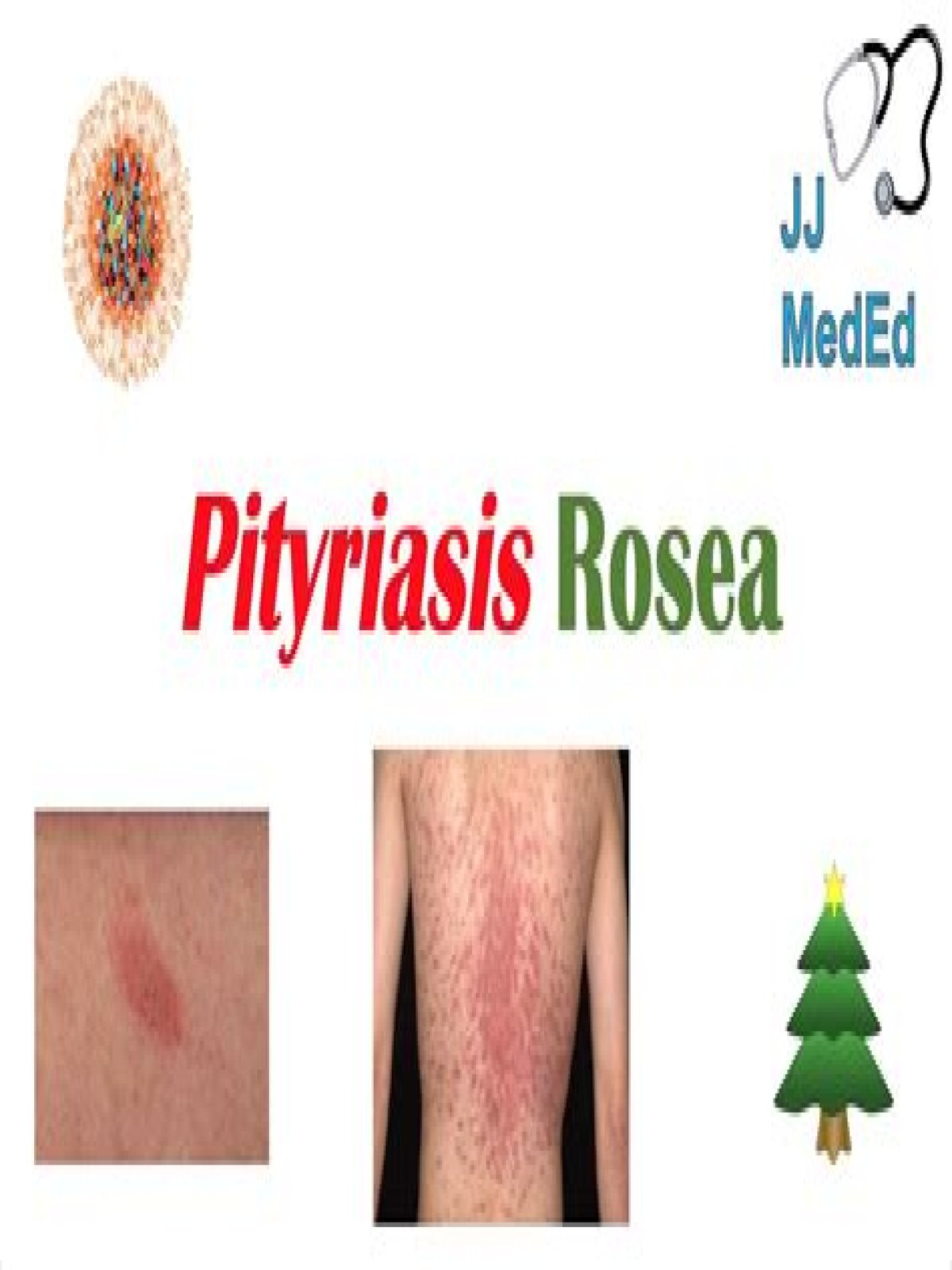 Can chlamydia cause pityriasis rosea