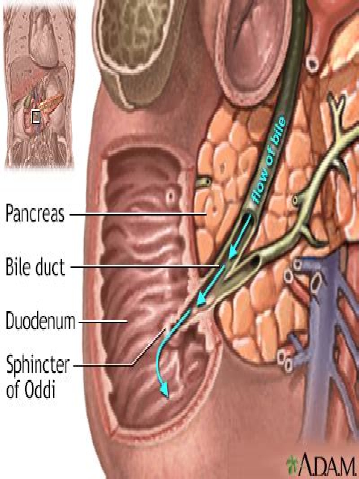 What is cystic duct obstruction