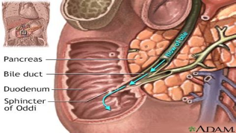 What is cystic duct obstruction